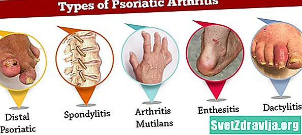 Bolehkah Anda Menghidap Psoriatik Artritis Jika Anda Tidak Mengalami Psoriasis?