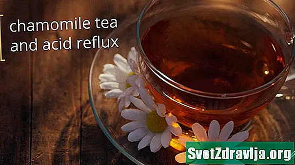 Možete li koristiti čaj od kamilice za liječenje refluksa kiselinom?