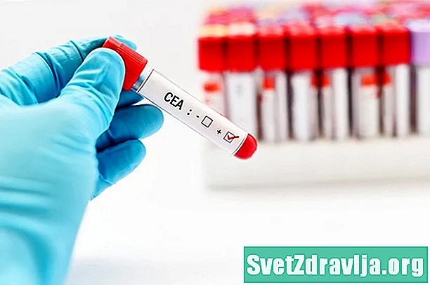 Test d'antigène carcinoembryonnaire (CEA) - Santé