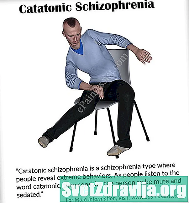 Esquizofrènia catatònica