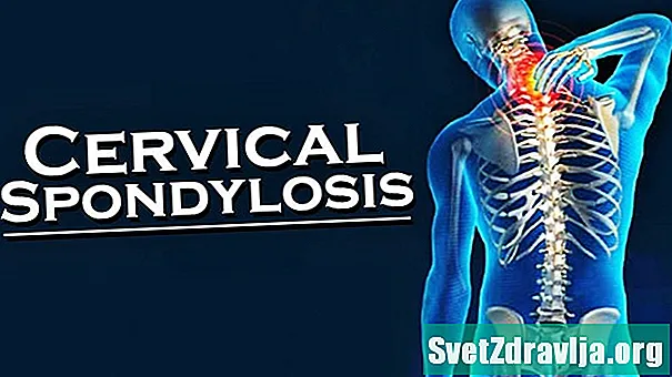 Cervikální spondylóza - Zdraví