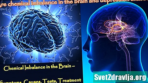 Kémiai egyensúlyhiány az agyban: Mit kell tudni - Egészség