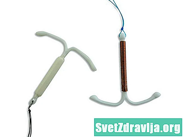 Výběr správného IUD: Mirena vs. ParaGard vs. Skyla - Zdraví