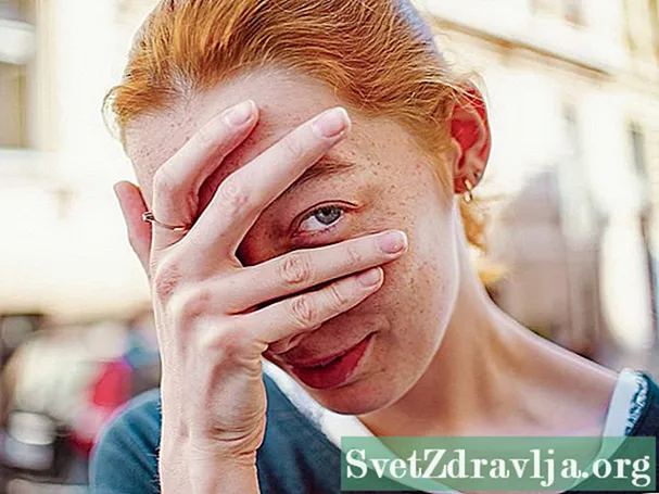 Kroniske tørre øyne: Statistikk, fakta og deg
