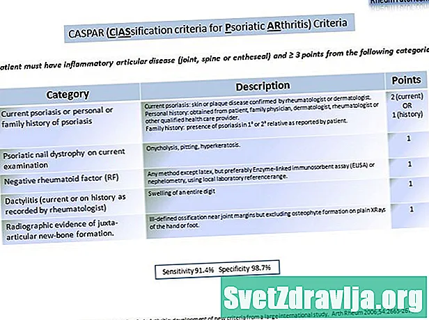 Kriteriji za razvrstavanje psorijatičnog artritisa - Zdravlje