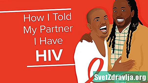私のHIVステータスについてパートナーに発表