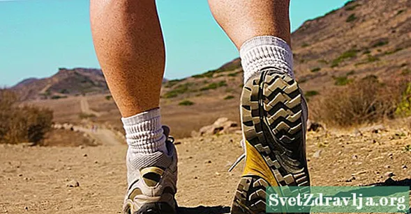 Bežné príčiny bolesti lýtka pri chôdzi - Wellness