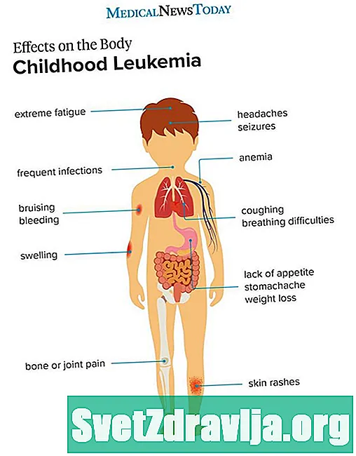 Símptomes comuns de leucèmia en nens