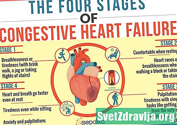 Kongestívne zlyhanie srdca (CHF) - Zdravie