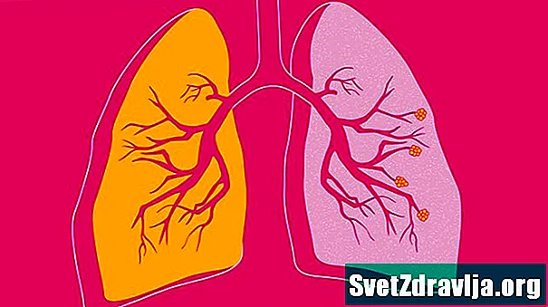 COPD: Staðreyndir, tölfræði og þú - Heilsa