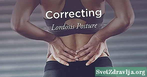 Core uye Hip Exercises Kururamisa Lordosis Posture
