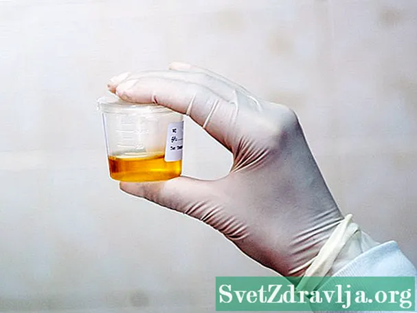 Test di urina di creatinina (Test di volume di urina 24 ore)