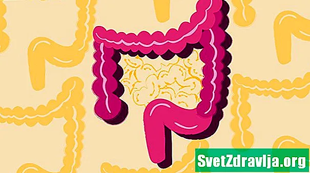 La maladie de Crohn: faits, statistiques et vous