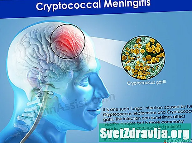 Meningitis kriptokokus