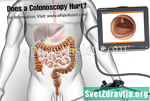 A dëmton kolonoskopia? - Shëndetësor
