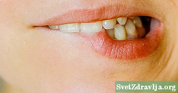 O herpes labial ajuda a curar mais rápido?