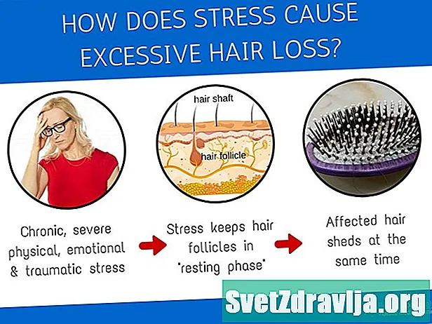 A shkakton stresi humbjen e flokëve? - Shëndetësor