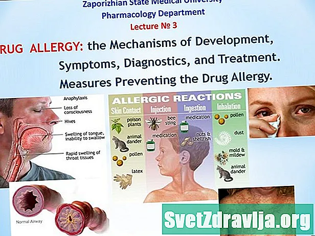 Narkootikumide allergia sümptomid - Tervis