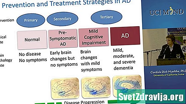 Drogy na Alzheimerovu chorobu: súčasné a vo vývoji - Zdravie