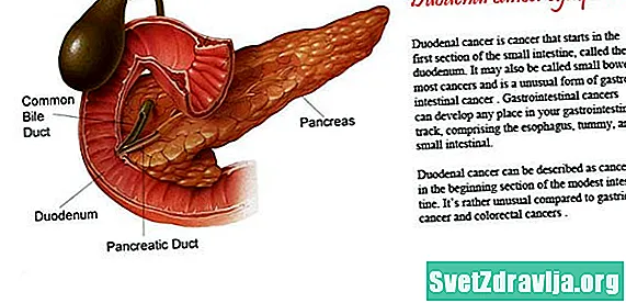 Duodenal cancer