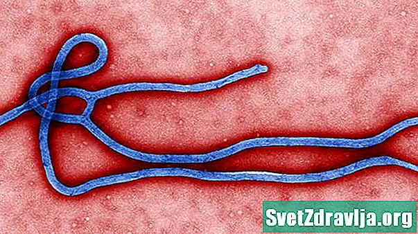 Víreas agus Galar Ebola - Sláinte