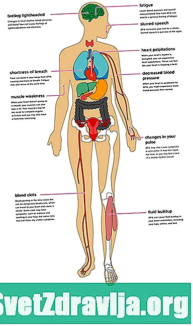 Atriyal Fibrilasyonun Vücut Üzerine Etkileri - Sağlık