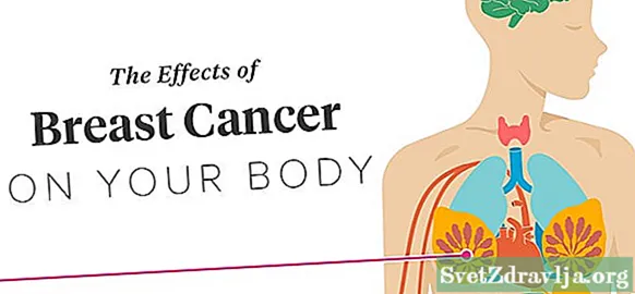 Učinki raka dojk na telo