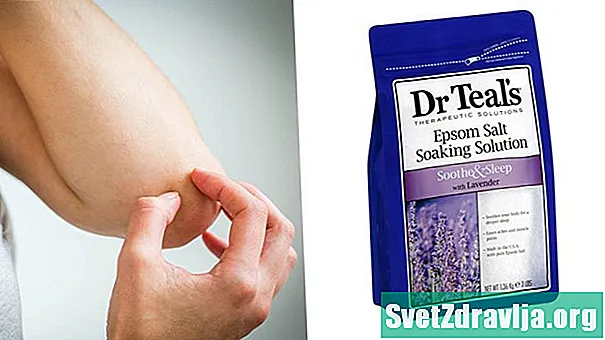 泻盐盐湿疹：它可以缓解疼痛吗？