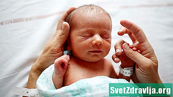 Tudo o que você precisa saber sobre a circuncisão do bebê - Saúde