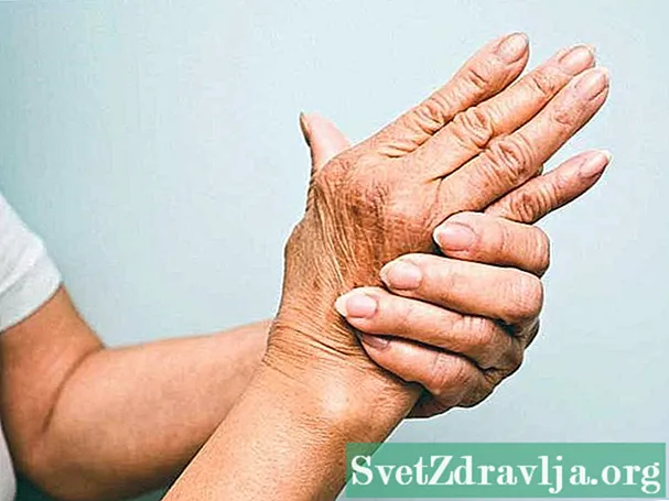Alles wat u moet weten over artritis psoriatica