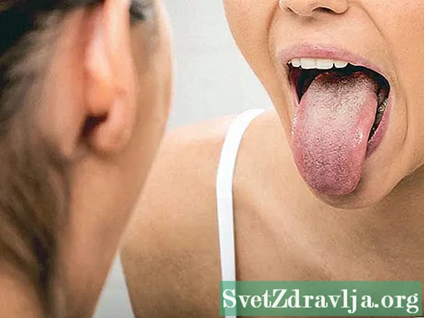 Alt du trenger å vite om tungekreft - Velvære