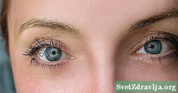 Göz Küresi Piercingi Hakkında Bilmek İstediğiniz Her Şey - Sağlık