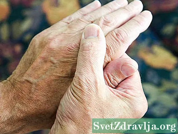 Sve što želite znati o reumatoidnom artritisu