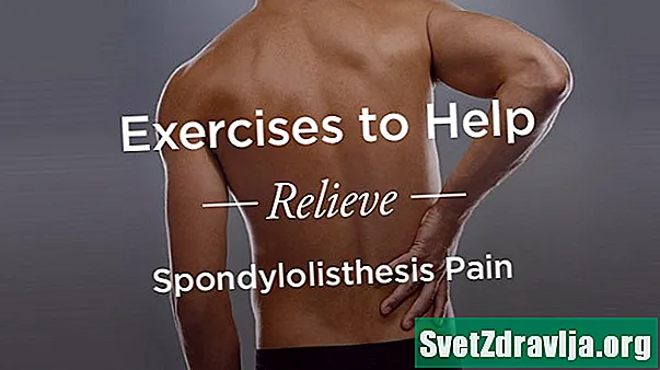 स्पोंडिलोलिस्थीसिस दर्द से राहत में मदद करने के लिए व्यायाम