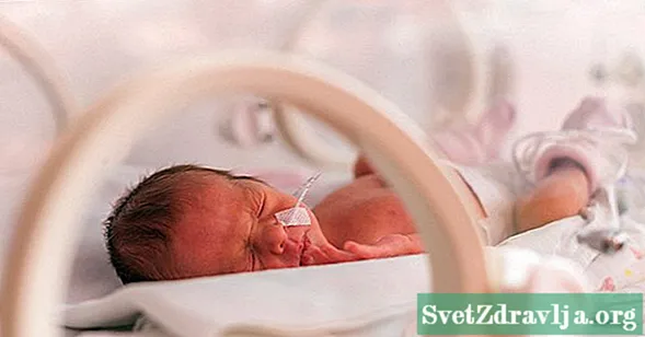 Oog- en oorproblemen bij premature baby's - Welzijn