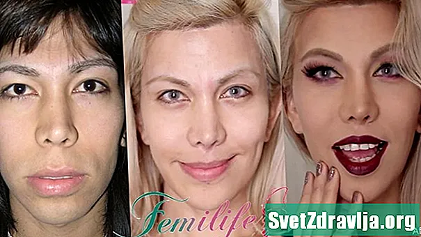 Kirurgija feminizacije lica: što biste trebali znati