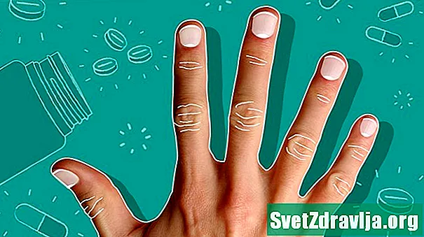 Ridgestest koorimiseni: mida need 8 sõrmeküüne märki teie tervise kohta ütlevad - Tervis