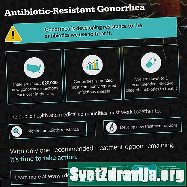 Gonorrhea Behandlung a Präventioun