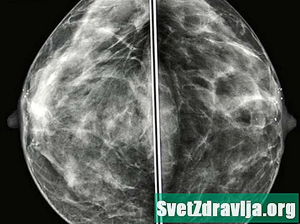 Udhëzues për imazhet e mamografisë