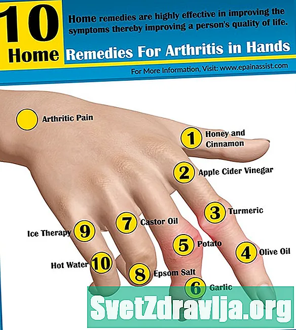 Arthrite des mains: symptômes, traitement, etc.