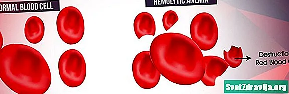 Anemia hemolitike: Whatfarë është dhe si ta trajtojmë atë - Shëndetësor