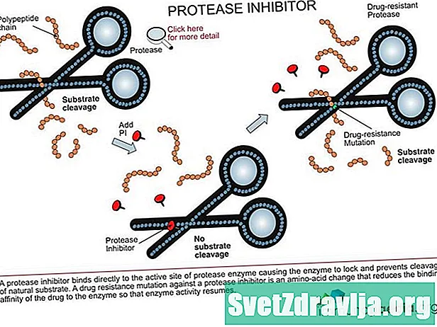 HIV: Sprievodca inhibítormi proteáz - Zdravie
