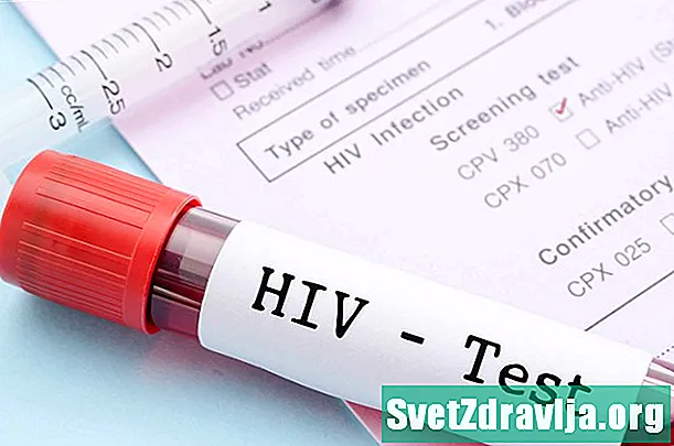 HIV-tesztek