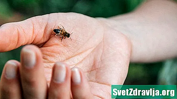 Domácí opravné prostředky pro Bee Stings: Co funguje?