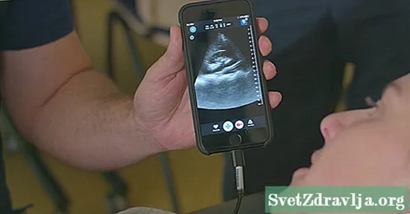 Paano Nailigtas ng Isang iPhone Ultrasound ang Buhay na Ito ng Doctor