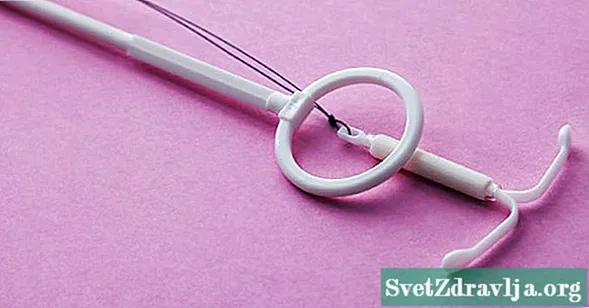Hoe beïnvloedt een intra-uterien apparaat (IUD) uw menstruatie?