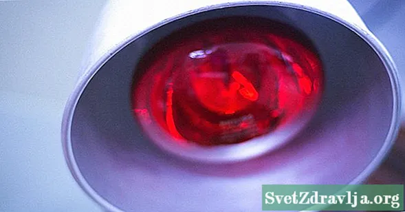 Kaip veikia psoriazės raudonosios šviesos terapija?