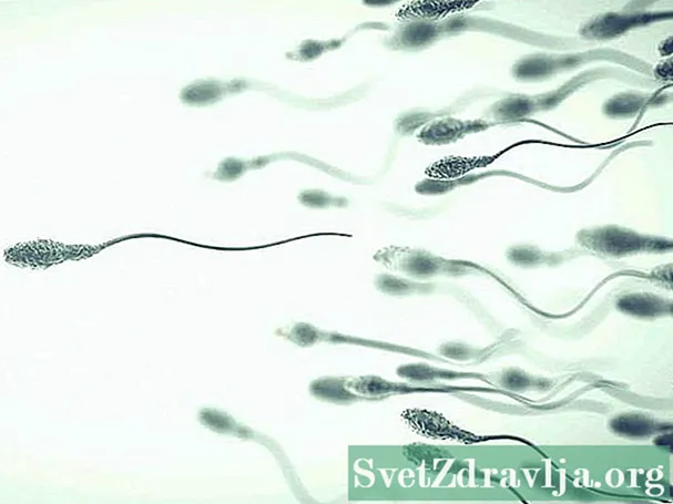 Como a morfologia do esperma afeta a fertilidade?