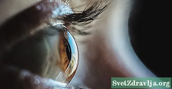 Hvordan Graves 'sygdom påvirker øjnene - Wellness