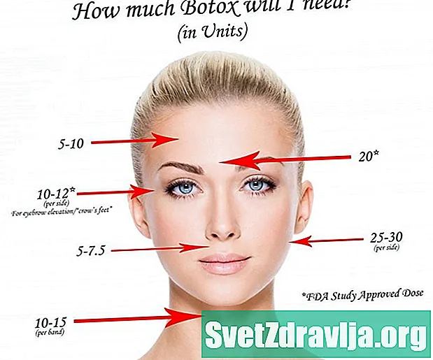 Kuinka Botoxia käytetään huulen injektioihin? - Terveys